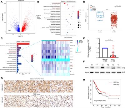 FBP1
/miR-24-1/enhancer axis activation blocks renal cell carcinoma progression via Warburg effect